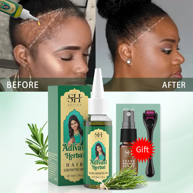 Ayurvedic Hair Growth Oil Indi - Ayurvedic & Herbal Wellness Kits ulasan dan harga
