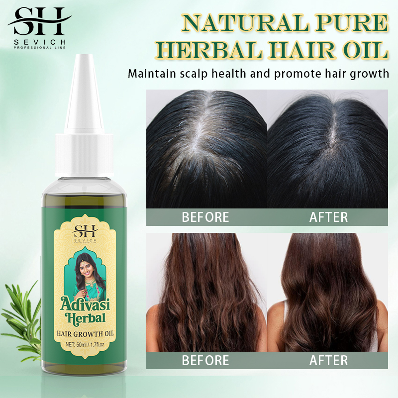 Ayurvedic Hair Growth Oil Adiv - Ayurvedic & Herbal Wellness Kits ulasan dan harga