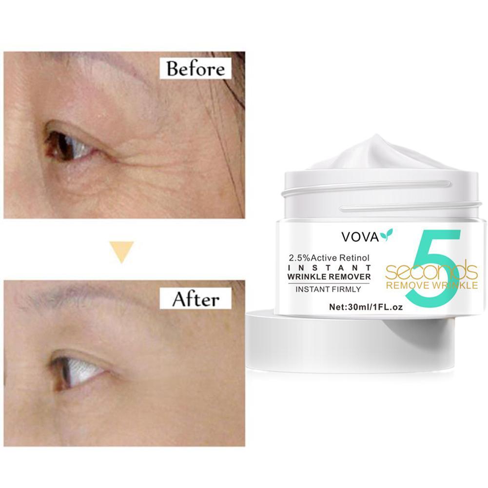 2.5% Active Retinol Eye Cream  - Milk Thistle Silymarin ulasan dan harga