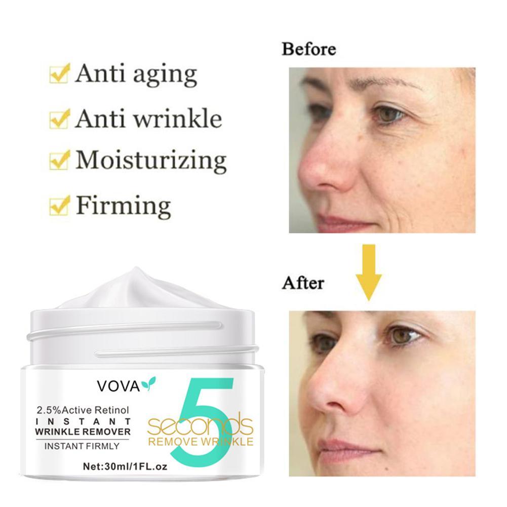 2.5% Active Retinol Eye Cream  - Milk Thistle Silymarin ulasan dan harga