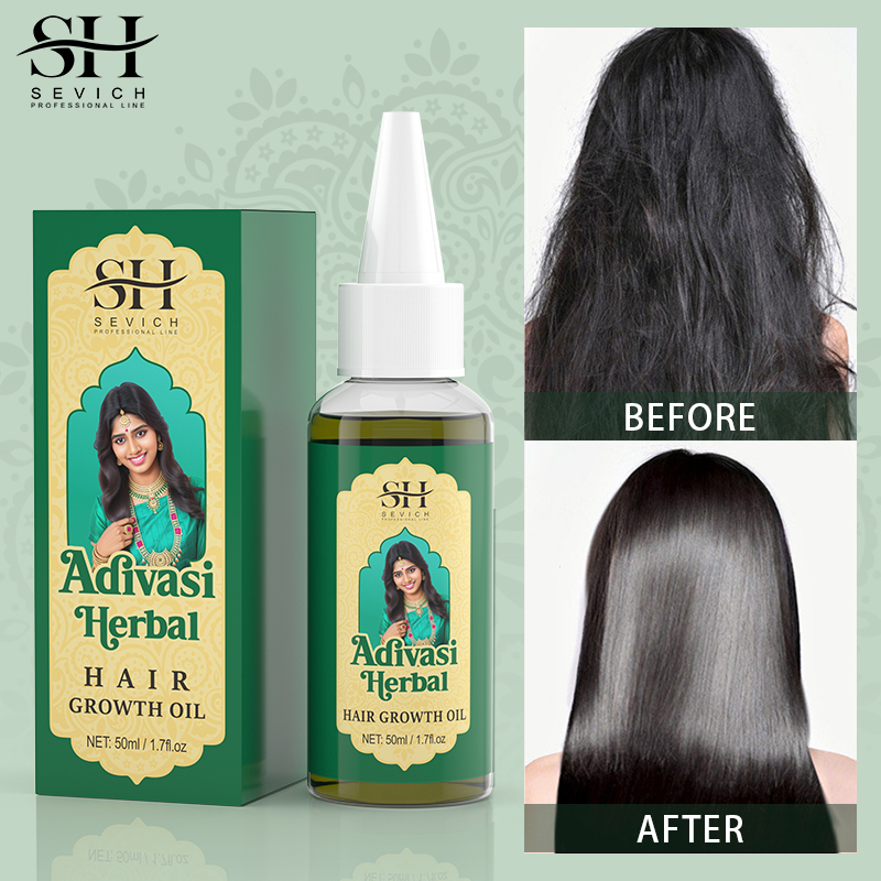 Sevich India Herbal Hair Growt - Ayurvedic & Herbal Wellness Kits ulasan dan harga
